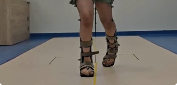 Clinical Gait Analysis for Children